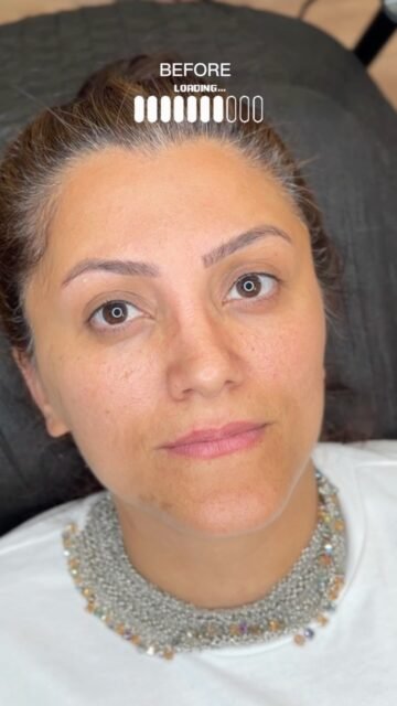 Aynadaki doğal değişime hazır mısınız?
Uzman dokunuşlarla uygulanan Tozlama Tekniği Kaş ve Dudak Renklendirme işlemleri, makyaj derdi olmadan her an canlı ve bakımlı görünmenizi sağlar.
Tozlama Tekniği: Kaşlarda yapaylıktan uzak, yumuşak ve kadifemsi bir gölge efekti oluşturur.
Dudak Renklendirme: Solgun görünümü siler, dudak çizginizi belirginleştirerek doğal bir canlılık katar.
Zamanınız size kalsın, güzelliğiniz her an parlasın.
📩
Detaylı bilgi ve randevu için DM’den ulaşabilirsiniz.
#İlknurMakeup #TozlamaTekniği #KaşTasarımı #DudakRenklendirme #KalıcıMakyaj